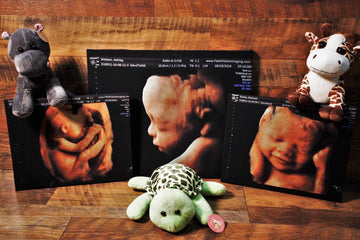 Wholesaler Spotlight: Fetal Vision Imaging - Philadelphia Delaware Valley