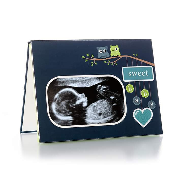 *Slightly Blemished* Blue Recordable Frame