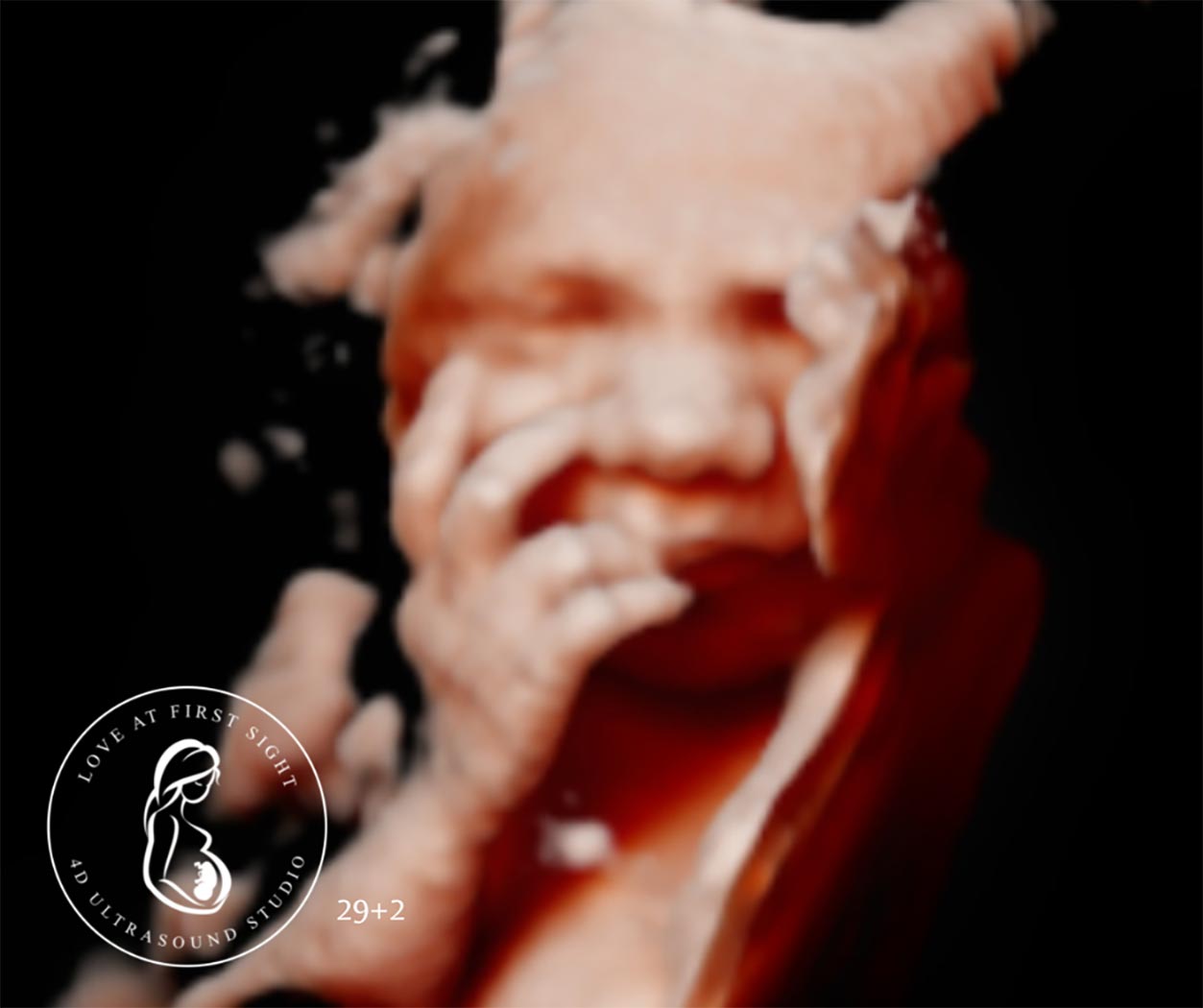 Spotlight: Love at First Sight 4D