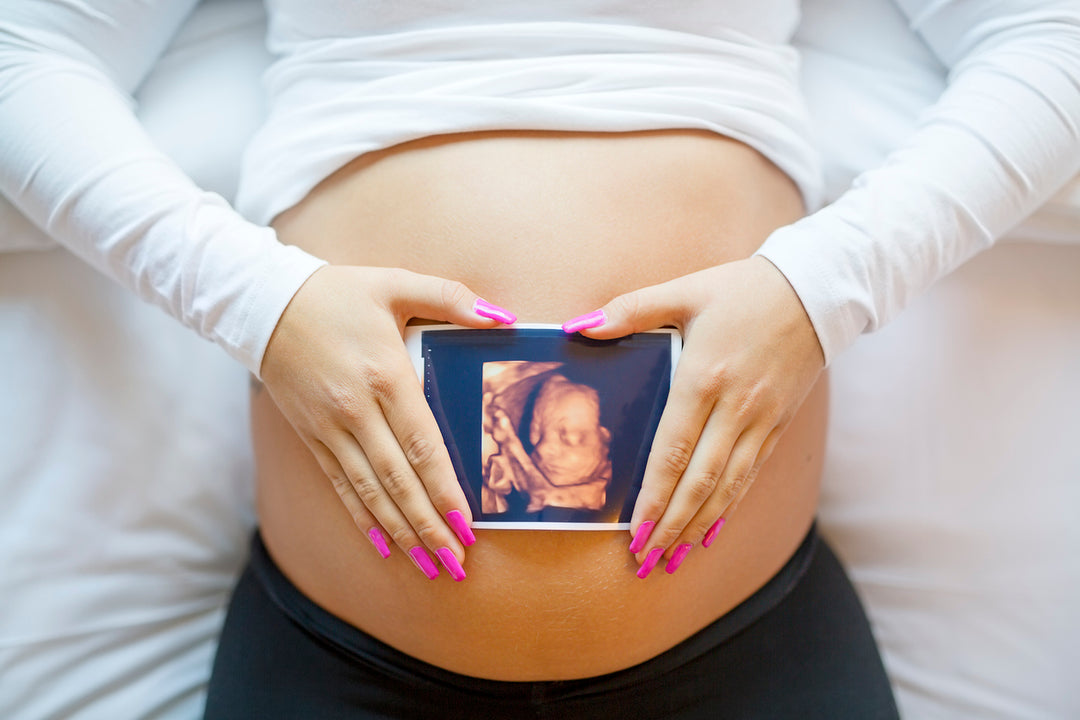 5 Black Friday Ideas for Your Ultrasound Office
