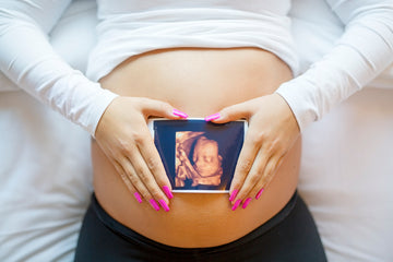 5 Black Friday Ideas for Your Ultrasound Office