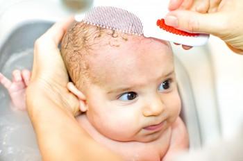 Baby Cradle Cap: Causes and Natural Cures