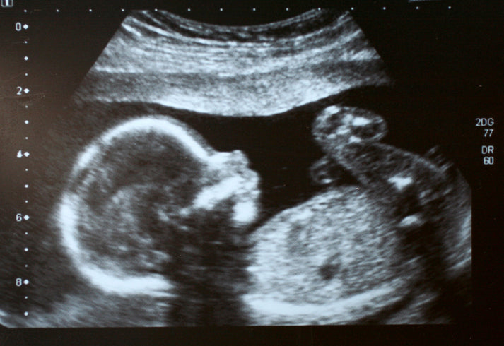 32 Old Wives Tales for Baby Gender Prediction