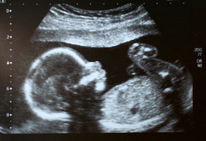 32 Old Wives Tales for Baby Gender Prediction