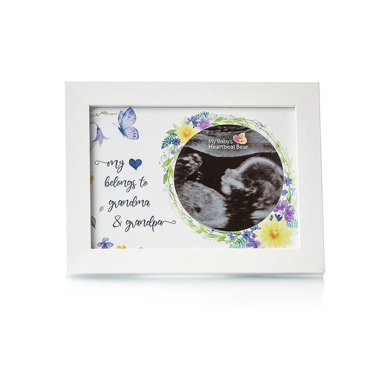 Load image into Gallery viewer, Ultrasound Frames
