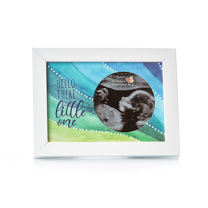 Ultrasound Frames