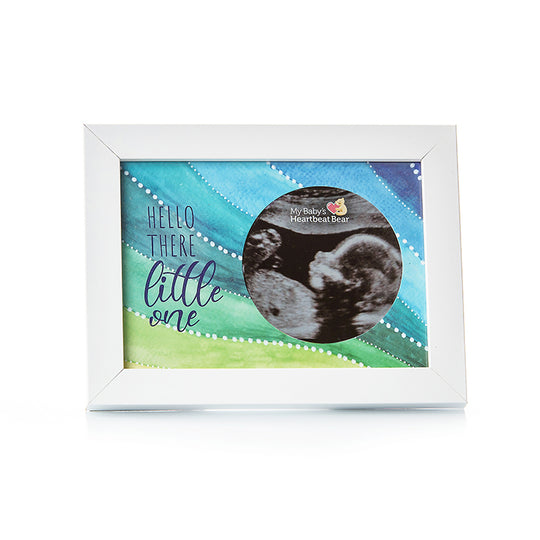 Ultrasound Frames