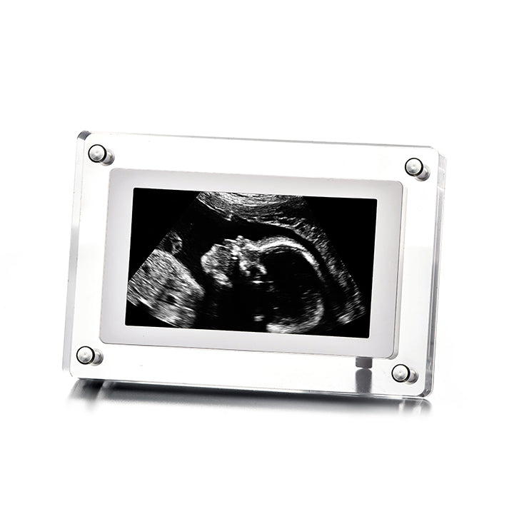 Customized Video Frame Digital Video Frame - My Baby's Heartbeat Bear