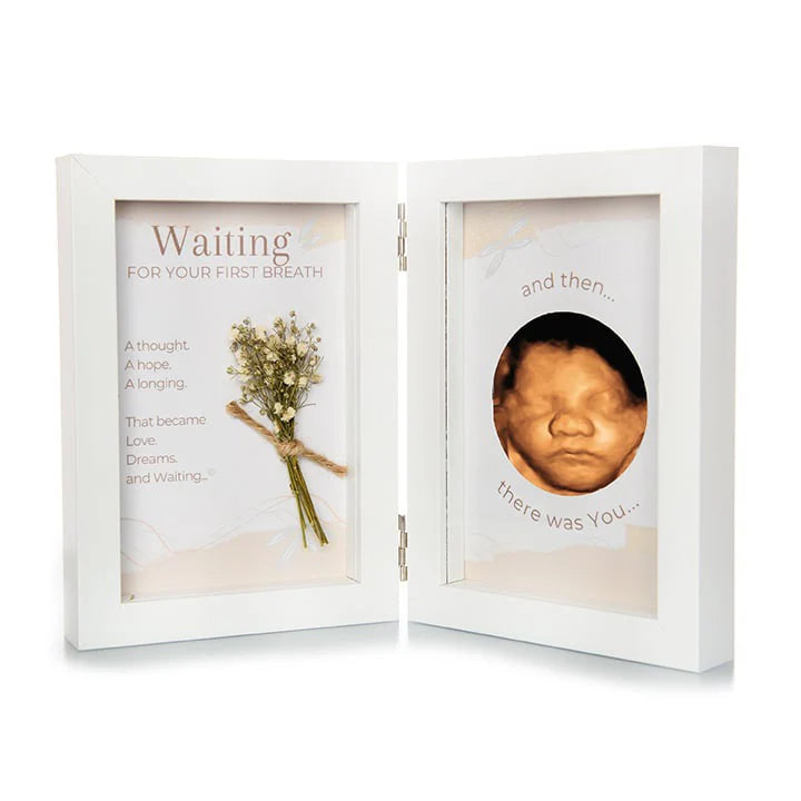 Ultrasound Frames