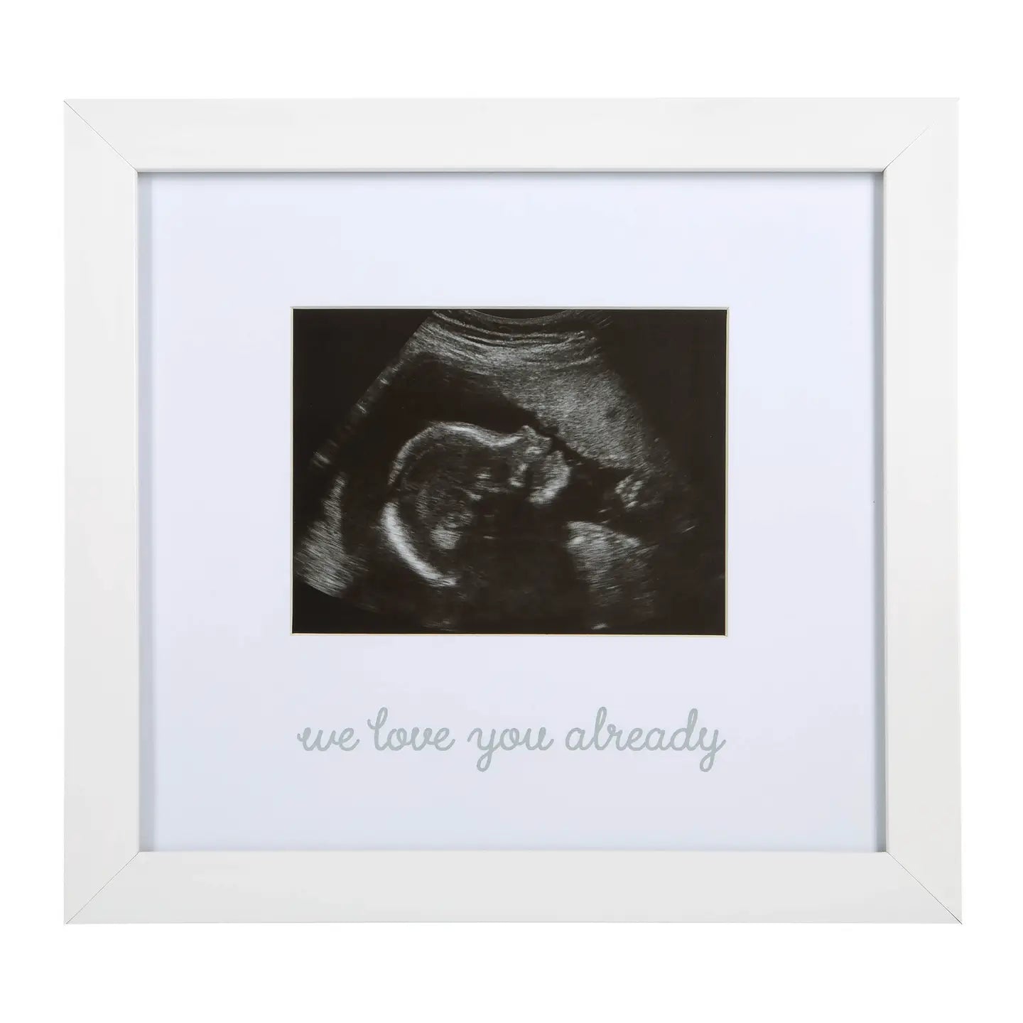 Ultrasound Frames