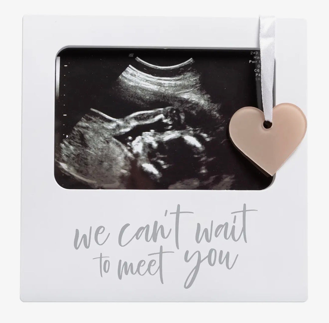 Ultrasound Frames