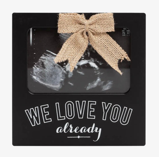 Ultrasound Frames