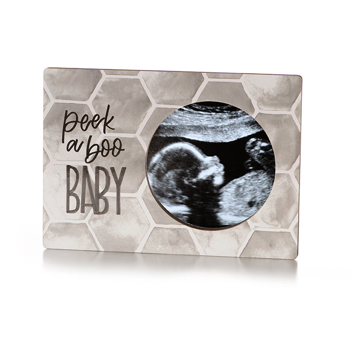 Magnetic Ultrasound Frames