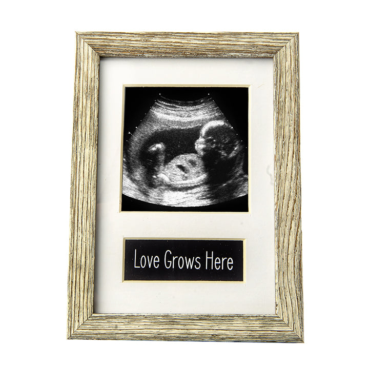Ultrasound Frames